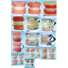 Equipo de Educación Científica Oral Dentición Estándar Modelo de Dientes Modelo de Prótesis